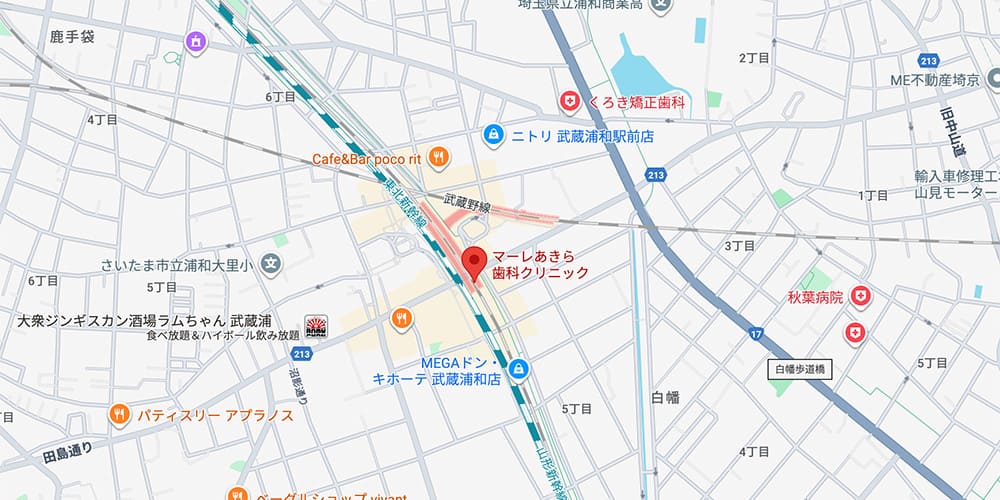 アクセス