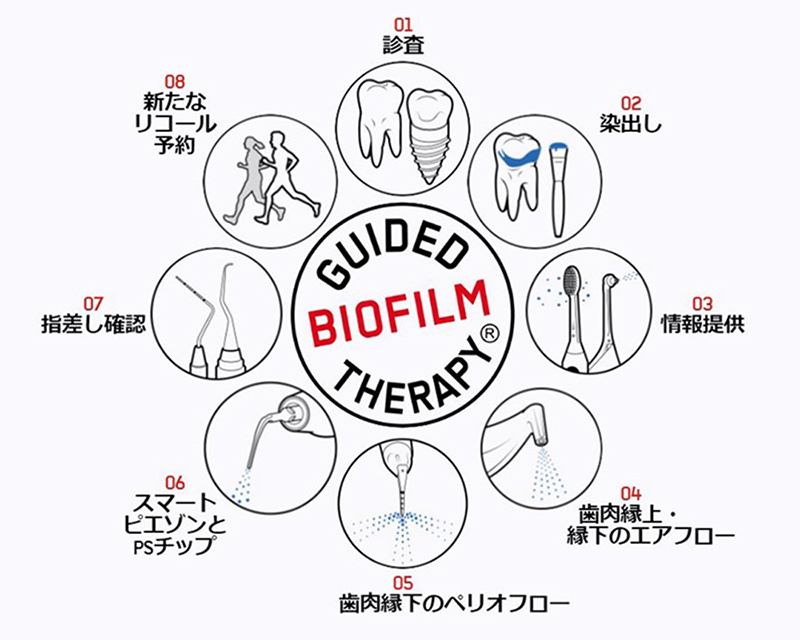 切らない歯周治療